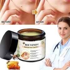 2026 Bee Venom Skin Tag Removal Treatment Cream Body Care Mole Corn Wart Remover