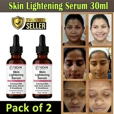 Skin Whitening Serum - Lighten Body Blemishes, Brighten Skin Tone, Protect Skin