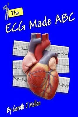 The ECG Made ABC by Gareth J. Mallon (English) Paperback Book