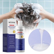 Anti-Fungal Shampoo For Folliculitis, Seborrheic, Dandruff 8.4Oz/250mL T9Q5