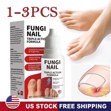 1-3PCS Fungi Nail Anti Fungal Liquid Formula Nail Repair Liquid Solution 15ml