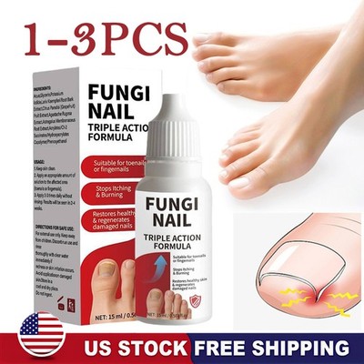 1-3PCS Fungi Nail Anti Fungal Liquid Formula Nail Repair Liquid Solution 15ml