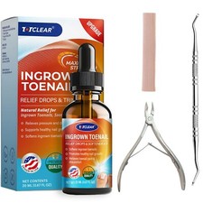 Ingrown Toenail Relief: Ingrown Toenail Tool at Home.Ingrown Toenail Remover..