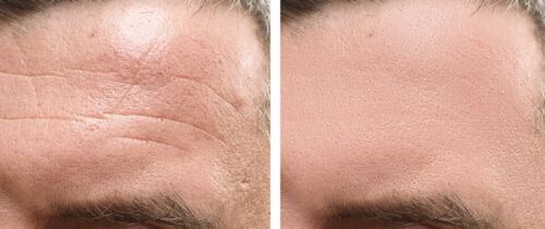Hyaluronic Acid 100% Pure Organic Deep Hydrating Serum Spa Formula 2x 6oz USA - Picture 13 of 17