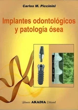 IMPLANTES ODONTOLOGICOS Y PATOLOGÍA OSEA