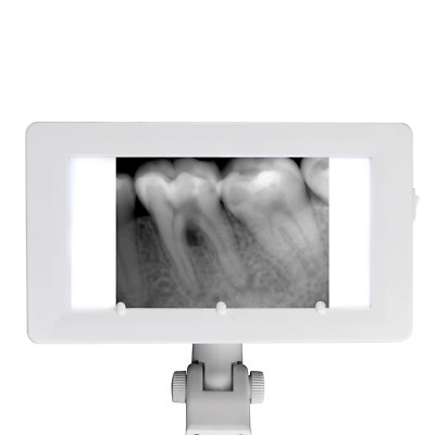 Dental Film Viewing Lamp AC 24V X-Ray Film Viewer Dental Chair Accessories