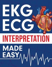 EKG | ECG Interpretation Made Easy: An Illust...