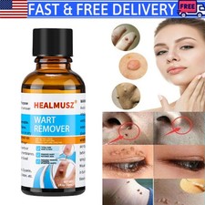 Painless Wart Remover Liquid Eliminate Skin Tag Foot Corn Mole Warts Restoration