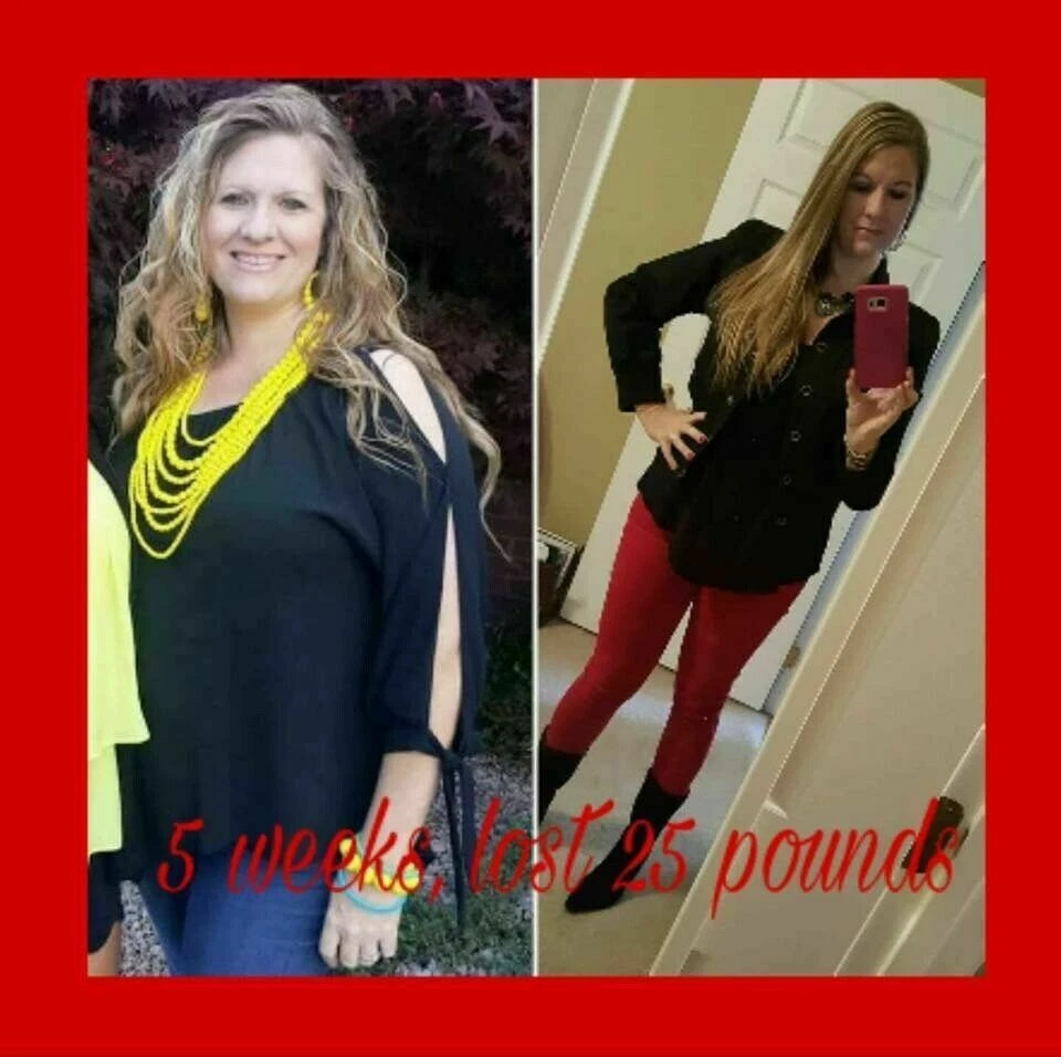 TruVision Health Tru + Combo de Energía y Pérdida de Peso 1 Mes (28 Días) Ahora Truvy * Foto 2 de 4