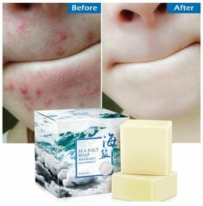 pores removal face wash