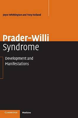 Prader-Willi Syndrome Development and Manifestations Whittington Holland