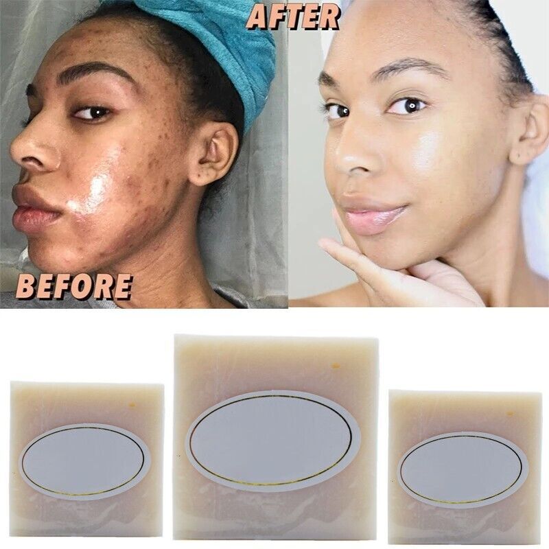 Bleaching Soap Side Effects