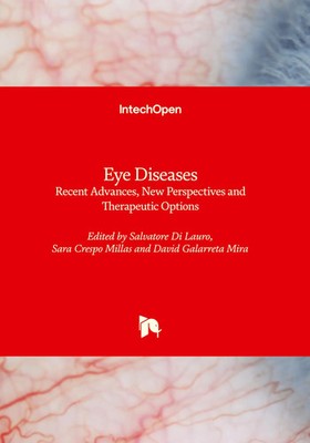 Salvatore Di Lauro (u. a.) | Eye Diseases | Buch | Englisch (2023) | IntechOpen