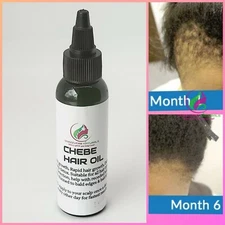 FAST HAIR GROWTH Organic Growth Oil  Balding Thin Edges Alopecia Chebe Miracle 