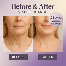 Neck Firming Cream 50g – Aavini Peptides & Collagen for Loose Skin | 30% OFF