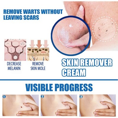 Natural Facial Dark Spot Remover Cream for Skin Repair and Smoothing Treatment