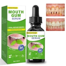 Gum Restore Drops Gum Repair Regrowth Gum Regrowth Treatment for Bad Breath G...