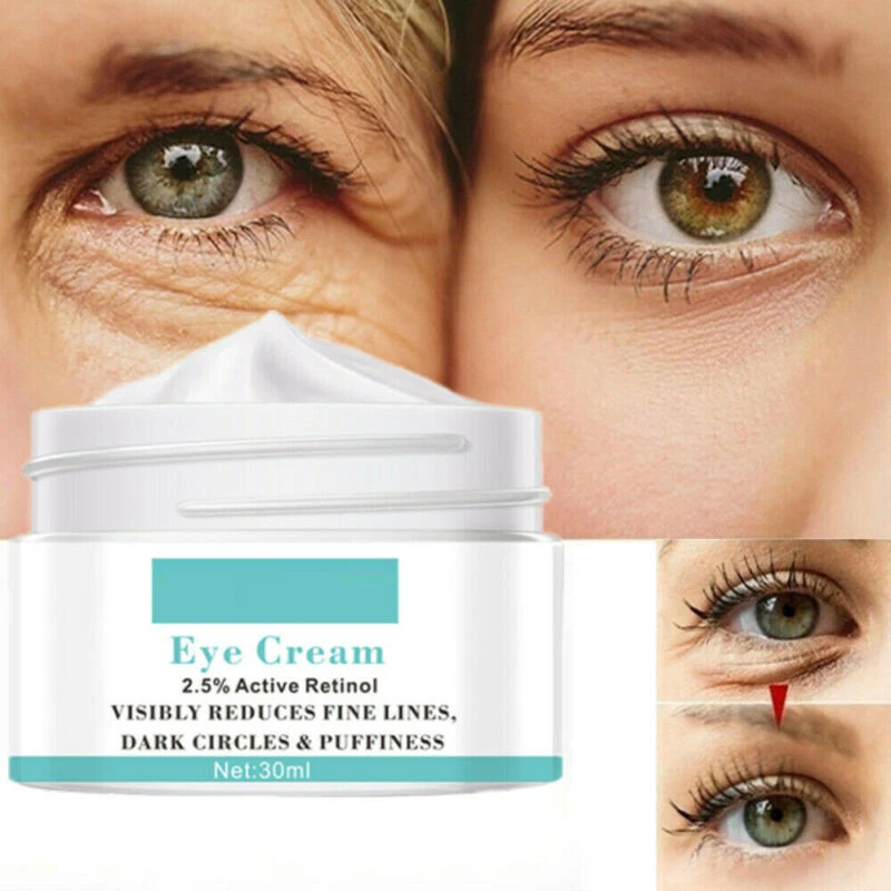 Top 76+ cream under eye bags in.duhocakina