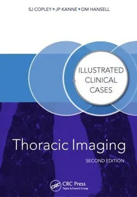Thoracic Imaging | Illustrated Clinical Cases, Second Edition | Hansell (u. a.)