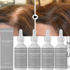 5PCS Deoxyribose Sugar Gel Hair Growth, Deoxyribose Serum for Hair Loss 60ml USA