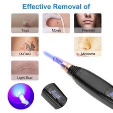 2ND Gen Laser Facial Skin Care Pen Blue/Red Light Spot Removal Anti-Aging Device