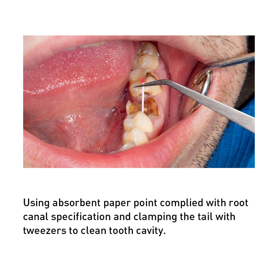 1 Box Dental Endodontic Root Canal Absorbent Paper Points 0.02/0.04/0.06 Taper - Image 4 of 4
