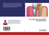 Priyanka Sarangi | An Insight Into Retrograde Filling Materials | Taschenbuch