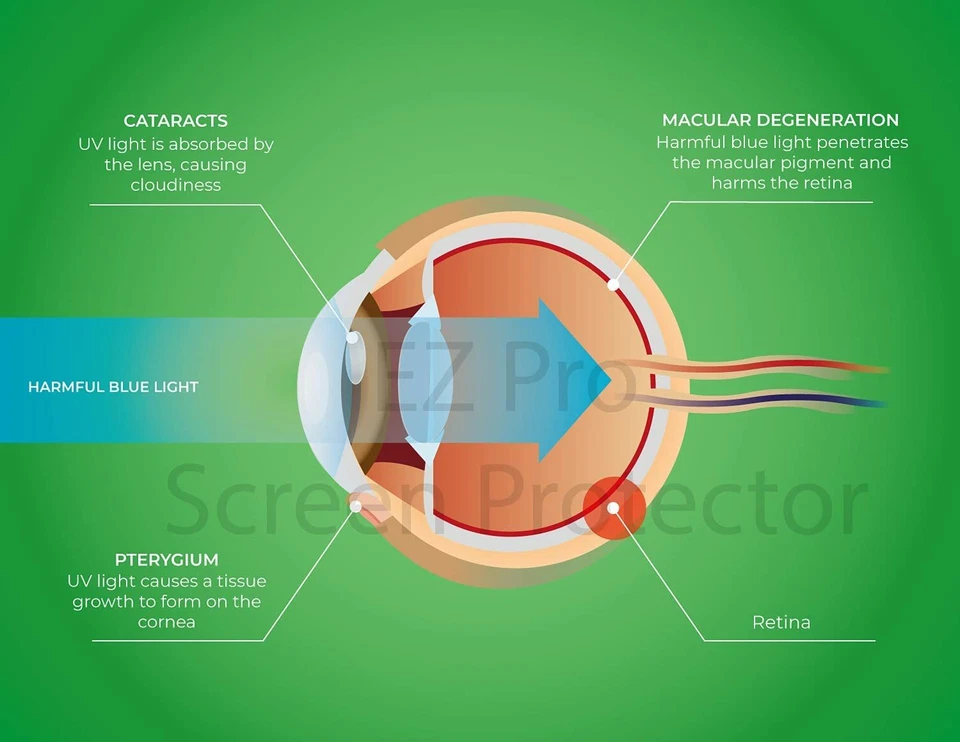 2X Anti Blue Light & Anti Glare Screen Protector for 13/14/15.6 inch 16:9 Laptop - Image 3 of 4