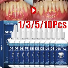 10/5PCS Oralhoe Tooth Care Solution Dental Cavity Healing Tooth Armor Gum Repair
