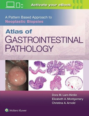 Atlas of Gastrointestinal Pathology: A Pattern Based Approach to Neoplastic Biop