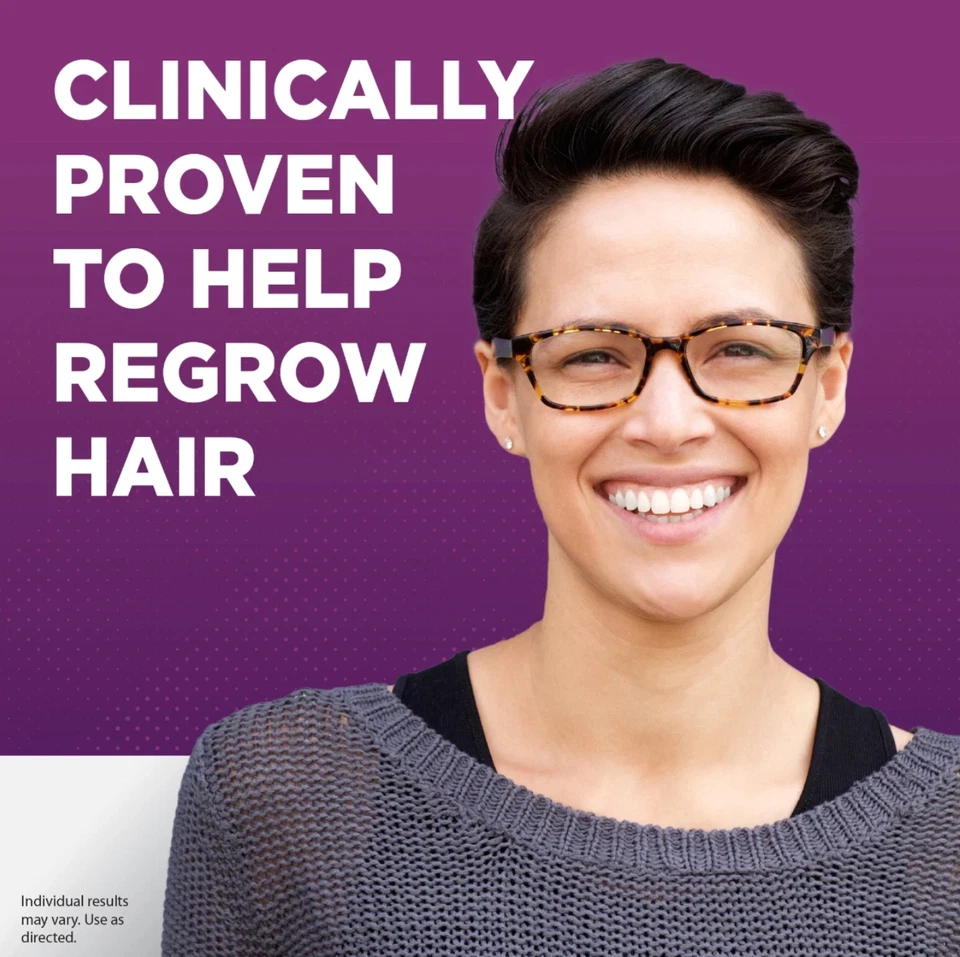 Kirkland Minoxidil 5% ESPUMA MUJERES Tratamiento de Regeneración del Cabello 12 Meses Foto 2 de 4