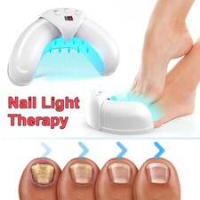 Onychomycosis Toes Nail Fungus Laser-Device Treatment For Home Use Light Therapy