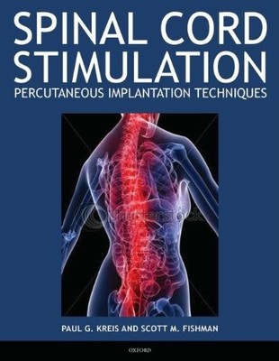 SPINAL CORD STIMULATION: PERCUTANEOUS IMPLANTATION By VG