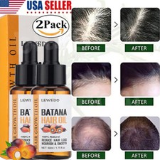 2 Organic Batana Oil Serum,50ml Natural Hair Growth Oil,Anti Hair Loss Treatment