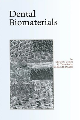 Edward Combe (u. a.) | Dental Biomaterials | Taschenbuch | Englisch (2013)