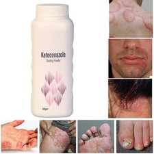 Powerful Antifungal Dusting Powder - Effective Treatment for Stubborn Ringworm