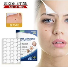 288PCS Skin Tag Remover Patches Acne Pimple Moles Wart Remover Cure Wart Patch