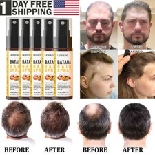 5Pcs Batana Oil Spray for Hair Growth, Natural Oil for Dry Damaged Hair Growth