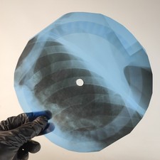 MONKEES TAPIOCA TUNDRA X-Ray USSR Record Roentgen Bone Ribs Music Vinyl