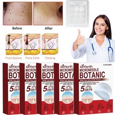 45 PCS Microneedle Botanic Skin Tag Acne Patch Skin Tag Remover Patches HOT