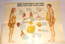 VTG 1974 "OVERWEIGHT CAN HURT MORE THAN JUST YOUR LOOKS" MEDICAL POSTER! 24x18"