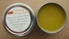 Calendula Healing Balm:  Improves Skin, Clears Rashes, Scars, Acne, Bites & Pain