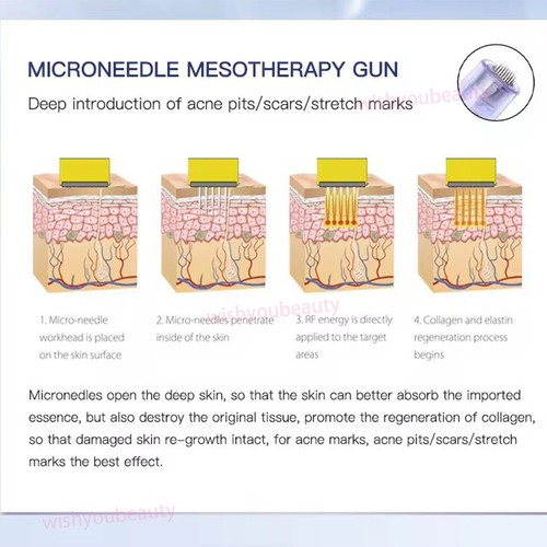 Parts for Skin Rejuvenation Machine Skin Water Pen Meso Gun Wrinkle Remove-USA - Picture 9 of 18