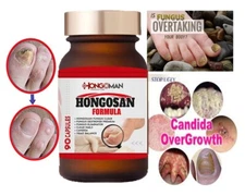 Hongosan for fungus 90 capsules concentrate tumba hongos