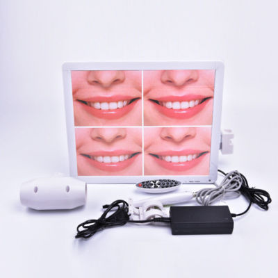 Dental Intraoral Camera HD 500W Pixel Resolution 17 Inch LCD Monitor WXD-1205