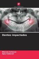 Bhavan Acharya (U. A.) | Dentes Impactados | Taschenbuch | Portugiesisch (2022)
