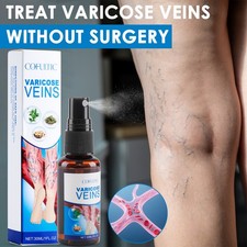 30ml Varicose Vein Spray Multi-Purpose Knee And Leg Care Spray Promote Blood Cir
