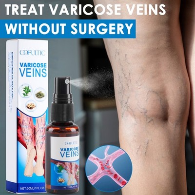 30ml Varicose Vein Spray Multi-Purpose Knee And Leg Care Spray Promote Blood Cir