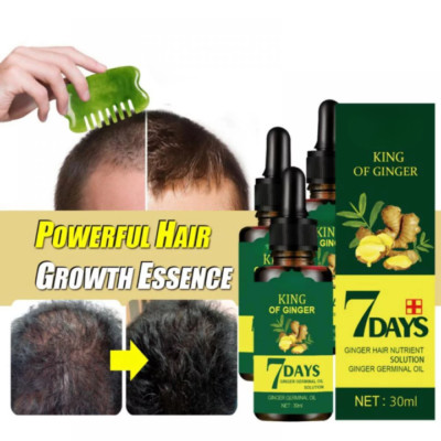 3X  King of Ginger Treatment Ginger Loss Growth Oil Thicker Healthier Hair 30ML