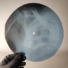 LED ZEPPELIN THE LEMON SONG X-Ray USSR Record Roentgen Bone Ribs Music Vinyl